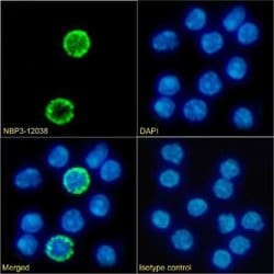 Common gamma Chain/IL-2 R gamma Rabbit anti-Mouse, Clone: 3000000000000,